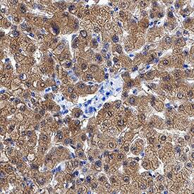 Ketohexokinase was detected in immersion fixed paraffin-embedded sections of human liver using Mouse Anti-Human Ketohexokinase Monoclonal Antibody (Catalog # MAB8177) at 5 µg/mL for 1 hour at room temperature followed by incubation with the Anti-Mouse IgG VisUCyte™ HRP Polymer Antibody (Catalog # VC001). Before incubation with the primary antibody, tissue was subjected to heat-induced epitope retrieval using Antigen Retrieval Reagent-Basic (Catalog # CTS013). Tissue was stained using DAB (brown) and counterstained with hematoxylin (blue). Specific staining was localized to cytoplasm in hepatocytes. View our protocol for IHC Staining with VisUCyte HRP Polymer Detection Reagents.
