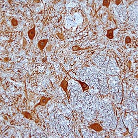 Kininogen was detected in immersion fixed paraffin-embedded sections of human brain (substantia nigra) using Mouse Anti-Human Kininogen Monoclonal Antibody (Catalog # MAB1569) at 0.5 µg/mL for 1 hour at room temperature followed by incubation with the Anti-Mouse IgG VisUCyte™ HRP Polymer Antibody (Catalog # VC001). Tissue was stained using DAB (brown) and counterstained with hematoxylin (blue). Specific staining was localized to neuronal cell bodies and processes. View our protocol for IHC Staining with VisUCyte HRP Polymer Detection Reagents.