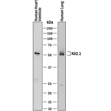 Western Blot Kir2.1 Antibody (2153C) [Unconjugated]