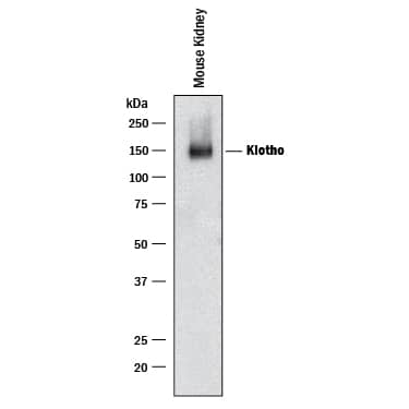 Western Blot Klotho Antibody [Unconjugated]