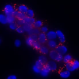 Klotho  beta  was detected in immersion fixed HepG2 human hepatocellular carcinoma cell line using Rabbit Anti-Human Klotho  beta  Monoclonal Antibody (Catalog # MAB58891) at 3 µg/mL for 3 hours at room temperature. Cells were stained using the NorthernLights™ 557-conjugated Anti-Rabbit IgG Secondary Antibody (red; Catalog # NL004) and counterstained with DAPI (blue). Specific staining was localized to cytoplasm. View our protocol for Fluorescent ICC Staining of Cells on Coverslips.