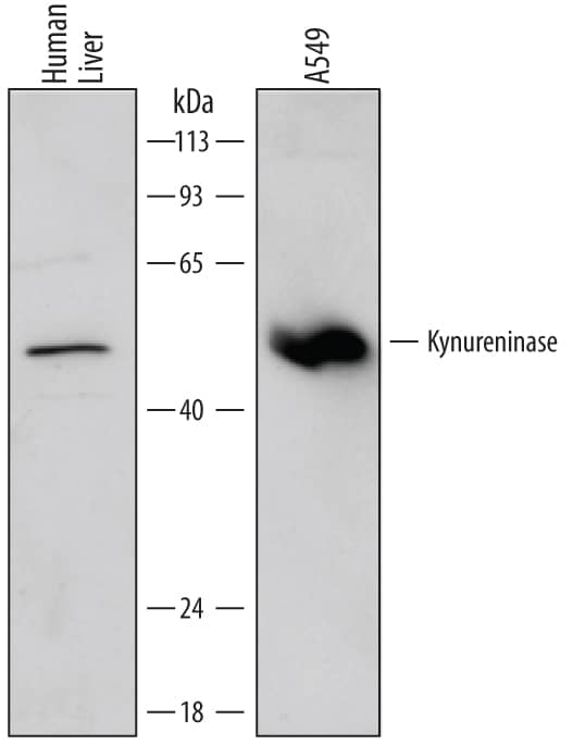 Western blot shows lysates of human liver tissue and A549 human lung carcinoma cell line. PVDF membrane was probed with 2 µg/mL of Mouse Anti-Human Kynureninase Monoclonal Antibody (Catalog # MAB4887) followed by HRP-conjugated Anti-Mouse IgG Secondary Antibody (Catalog # HAF007). A specific band was detected for Kynureninase at approximately 52 kDa (as indicated). This experiment was conducted under reducing conditions and using Immunoblot Buffer Group 1.