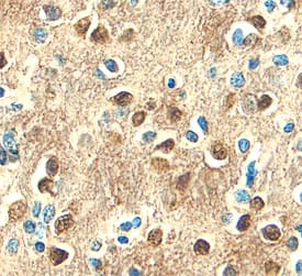 L1CAM was detected in immersion fixed paraffin-embedded sections of human brain (hippocampus) using Goat Anti-Human L1CAM Antigen Affinity-purified Poly-clonal Antibody (Catalog # AF277) at 10 µg/mL overnight at 4 °C. Before incubation with the primary antibody, tissue was subjected to heat-induced epitope retrieval using Antigen Retrieval Reagent-Basic (Catalog # CTS013). Tissue was stained using the Anti-Goat HRP-DAB Cell & Tissue Staining Kit (brown; Catalog # CTS008) and counter-stained with hematoxylin (blue). Specific staining was localized to plasma membranes and cytoplasm of neurons. View our protocol for Chromogenic IHC Staining of Paraffin-embedded Tissue Sections.
