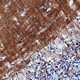 L1CAM was detected in immersion fixed paraffin-embedded sections of human brain (cerebellum) using Mouse Anti-Human L1CAM Monoclonal Antibody (Catalog # MAB7771) at 5 µg/mL for 1 hour at room temperature followed by incubation with the Anti-Mouse IgG VisUCyte™ HRP Polymer Antibody (Catalog # VC001). Before incubation with the primary antibody, tissue was subjected to heat-induced epitope retrieval using Antigen Retrieval Reagent-Basic (Catalog # CTS013). Tissue was stained using DAB (brown) and counterstained with hematoxylin (blue). Specific staining was localized to neuronal processes. View our protocol for IHC Staining with VisUCyte HRP Polymer Detection Reagents.