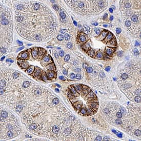 L1CAM was detected in immersion fixed paraffin-embedded sections of human kidney tissue using Mouse Anti-Human L1CAM Monoclonal Antibody (Catalog # MAB7771) at 5 µg/mL for 1 hour at room temperature followed by incubation with the Anti-Mouse IgG VisUCyte™ HRP Polymer Antibody (Catalog # VC001). Before incubation with the primary antibody, tissue was subjected to heat-induced epitope retrieval using Antigen Retrieval Reagent-Basic (Catalog # CTS013). Tissue was stained using DAB (brown) and counterstained with hematoxylin (blue). Specific staining was localized to cell membrane in epithelial cells in convoluted tubules. View our protocol for IHC Staining with VisUCyte HRP Polymer Detection Reagents.