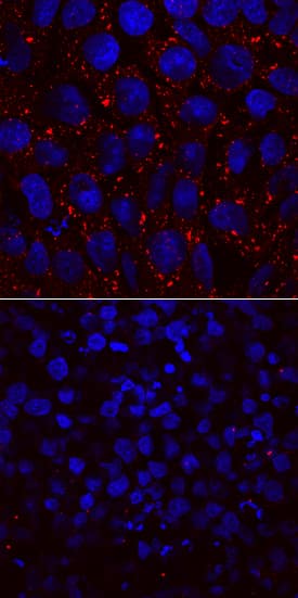 Immunocytochemistry L1TD1 Antibody (901258)