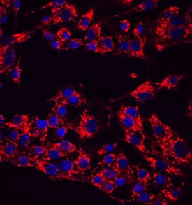 LAMP1/CD107a was detected in immersion fixed RAW 264.7 mouse monocyte/macrophage cell line using Goat Anti-Mouse LAMP1/CD107a Lumenal Domain Antigen Affinity-purified Polyclonal Antibody (Catalog # AF4320) at 10 µg/mL for 3 hours at room temperature. Cells were stained using the NorthernLights™ 557-conjugated Anti-Goat IgG Secondary Antibody (red; Catalog # NL001) and counterstained with DAPI (blue). Specific staining was localized to cytoplasm. View our protocol for Fluorescent ICC Staining of Cells on Coverslips.