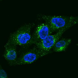 LAMP1/CD107a was detected in formaldehyde fixed HeLa human cervical epithelial carcinoma cell line using Sheep Anti-Human LAMP1/CD107a Alexa Fluor® 488‑conjugated Antigen Affinity-purified Polyclonal Antibody (Catalog # IC7985G) at 1:10 dilution for 3 hours at room temperature and counterstained with DAPI (blue). Specific staining was localized to lysosomes. View our protocol for Fluorescent ICC Staining of Cells on Coverslips.