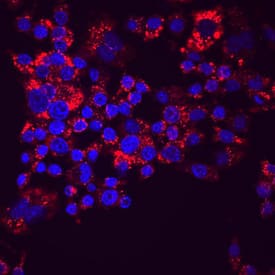 LAMP1/CD107a was detected in immersion fixed RAW 264.7 mouse monocyte/macrophage cell line using Rat Anti-Mouse LAMP1/CD107a Monoclonal Antibody (Catalog # MAB4320) at 10 µg/mL for 3 hours at room temperature. Cells were stained using the NorthernLights™ 557-conjugated Anti-Rat IgG Secondary Antibody (red; Catalog # NL013) and counterstained with DAPI (blue). Specific staining was localized to cytoplasm. View our protocol for Fluorescent ICC Staining of Cells on Coverslips.