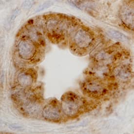 LAMP1/CD107a was detected in immersion fixed paraffin-embedded sections of human kidney using Mouse Anti-Human LAMP1/CD107a Monoclonal Antibody (Catalog # MAB4800) at 15 µg/mL overnight at 4 °C. Before incubation with the primary antibody, tissue was subjected to heat-induced epitope retrieval using Antigen Retrieval Reagent-Basic (Catalog # CTS013). Tissue was stained using the Anti-Mouse HRP-DAB Cell & Tissue Staining Kit (brown; Catalog # CTS002) and counterstained with hematoxylin (blue). Specific staining was localized to lysosomes in epithelial cells. View our protocol for Chromogenic IHC Staining of Paraffin-embedded Tissue Sections.