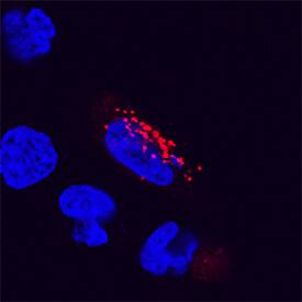 LAMP2/CD107b was detected in immersion fixed HeLa human cervical epithelial carcinoma cell line using Goat Anti-Human LAMP2/CD107b Antigen Affinity-purified Polyclonal Antibody (Catalog # AF6228) at 15 µg/mL for 3 hours at room temperature. Cells were stained using the Northern-Lights™ 557-conjugated Anti-Goat IgG Secondary Antibody (red; Catalog # NL001) and counterstained with DAPI (blue). Specific staining was localized to lysosomes. View our protocol for Fluorescent ICC Staining of Cells on Coverslips.