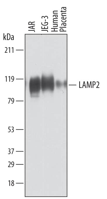 Western blot shows lysates of JAR human choriocarcinoma cell line, JEG-3 human epithelial choriocarcinoma cell line, and human placenta tissue. PVDF membrane was probed with 1 µg/mL of Goat Anti-Human LAMP2/CD107b Antigen Affinity-purified Polyclonal Antibody (Catalog # AF6228) followed by HRP-conjugated Anti-Goat IgG Secondary Antibody (Catalog # HAF019). Specific bands were detected for LAMP2/CD107b at approximately 100-120 kDa (as indicated). This experiment was conducted under reducing conditions and using Immunoblot Buffer Group 1.