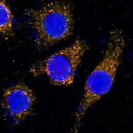 LAMP2/CD107b was detected in formaldehyde fixed HeLa human cervical epithelial carcinoma cell line using Mouse Anti-Human LAMP2/CD107b Biotinylated Monoclonal Antibody (Catalog # BAM6228) at 25 µg/mL for 3 hours at room temperature. Cells were stained using the NorthernLights™ 557-conjugated Streptavidin (orange; Catalog # NL999) and counterstained with DAPI (blue). Specific staining was localized to lysosomes. View our protocol for Fluorescent ICC Staining of Cells on Coverslips.
