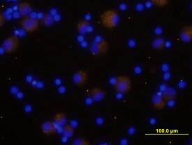 TGF-beta 1 was detected in immersion fixed human peripheral blood mononuclear cells (PBMCs) using Goat Anti-Human LAP TGF-beta 1 Polyclonal Antibody (Catalog # AB-246-NA) at 10 µg/mL for 3 hours at room temperature. Cells were stained using the NorthernLights™ 557-conjugated Anti-Goat IgG Secondary Antibody (yellow; Catalog # NL001) and counter-stained with DAPI (blue).View our protocol for Fluorescent ICC Staining of Non-adherent Cells.