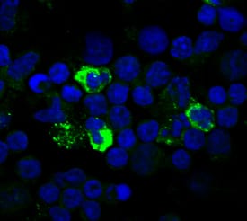 LAP (TGF-beta 1) was detected in immersion fixed human peripheral blood mononuclear cells (PBMCs) stimulated with CD3/CD28/TGF-beta/IL-2 using Mouse Anti-Human LAP (TGF-beta 1) Alexa Fluor® 488‑conjugated Monoclonal Antibody (green; Catalog # FAB2463G) at 5 µg/mL for 3 hours at room temperature. Cells were counterstained with DAPI (blue). View our protocol for Fluorescent ICC Staining of Non-adherent Cells.