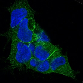 LAP (TGF-beta 1) was detected in immersion fixed HEK293 human embryonic kidney cell line using Mouse Anti-Human LAP (TGF-beta 1) Monoclonal Antibody (Catalog # MAB246) at 3 µg/mL for 3 hours at room temperature. Cells were stained using the NorthernLights™ 493-conjugated Anti-Mouse IgG Secondary Antibody (green; Catalog # NL009) and counterstained with DAPI (blue). Specific staining was localized to cytoplasm. View our protocol for Fluorescent ICC Staining of Cells on Coverslips.