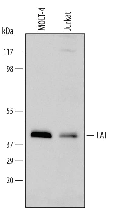 Western blot shows lysates of MOLT-4 human acute lymphoblastic leukemia cell line and Jurkat human acute T cell leukemia cell line. PVDF Membrane was probed with 1 µg/mL of Sheep Anti-Human LAT Antigen Affinity-purified Polyclonal Antibody (Catalog # AF6208) followed by HRP-conjugated Anti-Sheep IgG Secondary Antibody (Catalog # HAF016). A specific band was detected for LAT at approximately 40 kDa (as indicated). This experiment was conducted under reducing conditions and using Immunoblot Buffer Group 2.