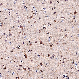 LC3A was detected in immersion fixed paraffin-embedded sections of human brain (cortex) using Rat Anti-Human LC3A Monoclonal Antibody (Catalog # MAB8558) at 1.7 µg/mL overnight at 4 °C. Tissue was stained using the Anti-Rat HRP-DAB Cell & Tissue Staining Kit (brown; Catalog # CTS017) and counterstained with hematoxylin (blue). Specific staining was localized to cytoplasm. View our protocol for Chromogenic IHC Staining of Paraffin-embedded Tissue Sections.