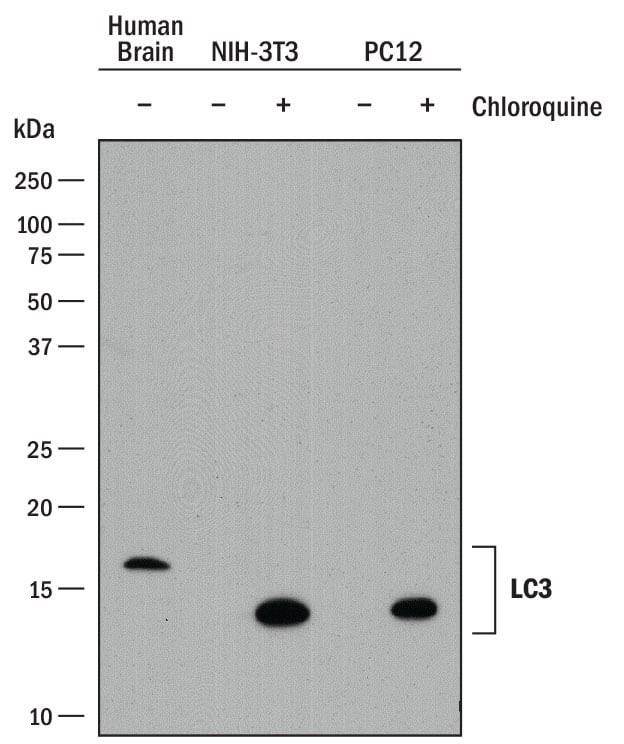Western blot shows lysates of human brain tissue, NIH-3T3 mouse embryonic fibroblast cell line, and PC-12 rat adrenal pheochromocytoma cell line untreated (-) or treated (+) with 50 µM Chloroquine for 18 hours. PVDF membrane was probed with 2 µg/mL of Rat Anti-Human LC3A Antibody (Catalog # MAB8558) followed by HRP-conjugated Anti-Rat IgG Secondary Antibody (Catalog # HAF005). Specific bands were detected for LC3A at approximately 14 and 16 kDa (as indicated). This experiment was conducted under reducing conditions and using Immunoblot Buffer Group 1.