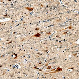 <b>Biological Strategies Validation. </b>LC3A was detected in immersion fixed paraffin-embedded sections of human brain cortex tissue using Rat Anti-Human LC3A Monoclonal Antibody (Catalog # MAB8558) at 15 µg/mL overnight at 4 °C. Tissue was stained using the Anti-Rat HRP-DAB Cell & Tissue Staining Kit (brown; Catalog # CTS017) and counterstained with hematoxylin (blue). Specific staining was localized to neurons. View our protocol for Chromogenic IHC Staining of Paraffin-embedded Tissue Sections.