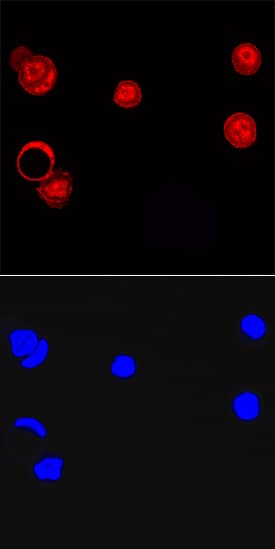 Immunocytochemistry LCoR Antibody (731229)