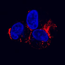LDL R was detected in immersion fixed HepG2 human hepatocellular carcinoma cell line using Goat Anti-Human LDL R Antigen Affinity-purified Polyclonal Antibody (Catalog # AF2148) at 1.7 µg/mL for 3 hours at room temperature. Cells were stained using the NorthernLights™ 557-conjugated Anti-Goat IgG Secondary Antibody (red; Catalog # NL001) and counterstained with DAPI (blue). Specific staining was localized to cytoplasm. View our protocol for Fluorescent ICC Staining of Cells on Coverslips.
