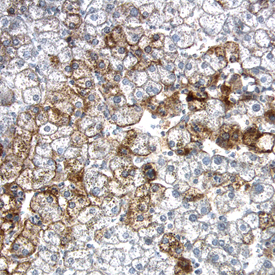 LDL R was detected in formalin fixed paraffin-embedded sections of human liver using Goat Anti-Human LDL R Antigen Affinity-purified Polyclonal Antibody (Catalog # AF2148) at 15 µg/mL overnight at 4 °C. Tissue was stained using the Anti-Goat HRP-DAB Cell & Tissue Staining Kit (brown; Catalog # CTS008) and counterstained with hematoxylin (blue). View our protocol for Chromogenic IHC Staining of Paraffin-embedded Tissue Sections.