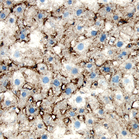 LDL R was detected in perfusion fixed frozen sections of mouse liver using Mouse LDL R Antigen Affinity-purified Polyclonal Antibody (Catalog # AF2255) at 15 &micro;g/mL overnight at 4 &deg;C. Tissue was stained using the Anti-Goat HRP-DAB Cell & Tissue Staining Kit (brown; Catalog # CTS008) and counterstained with hematoxylin (blue). Specific labeling was localized to the bile canaliculi. View our protocol for Chromogenic IHC Staining of Frozen Tissue Sections.