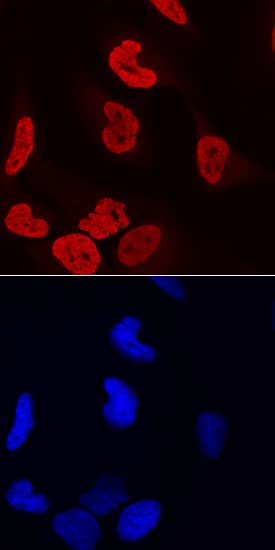 LEDGF was detected in immersion fixed HeLa human cervical epithelial carcinoma cell line using Goat Anti-Human LEDGF Antigen Affinity-purified Polyclonal Antibody (Catalog # AF3468) at 10 µg/mL for 3 hours at room temperature. Cells were stained using the NorthernLights™ 557-conjugated Anti-Goat IgG Secondary Antibody (red, upper panel; Catalog # NL001) and counterstained with DAPI (blue, lower panel). Specific staining was localized to nuclei. View our protocol for Fluorescent ICC Staining of Cells on Coverslips.