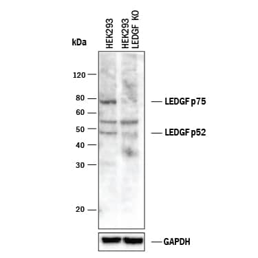 Western blot shows lysates of HeLa human cervical epithelial carcinoma parental cell line and LEDGF knockout HeLa cell line (KO). PVDF membrane was probed with 0.5 µg/mL of Goat Anti-Human LEDGF Antigen Affinity-purified Polyclonal Antibody (Catalog # AF3468) followed by HRP-conjugated Anti-Goat IgG Secondary Antibody (Catalog # HAF017). Specific bands were detected for LEDGF p75 at approximately 75 kDa and LEDGF p52 at approximately 49 kDa (as indicated) in the parental HeLa cell line, but is not detectable in knockout HeLa cell line. GAPDH (Catalog # AF5718) is shown as a loading control. This experiment was conducted under reducing conditions and using Immunoblot Buffer Group 1.