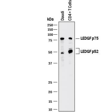 Western blot shows lysates of Daudi human Burkitt's lymphoma cell line and human CD4+T cells. PVDF membrane was probed with 0.5 µg/mL of Goat Anti-Human LEDGF Antigen Affinity-purified Polyclonal Antibody (Catalog # AF3468) followed by HRP-conjugated Anti-Goat IgG Secondary Antibody (Catalog # HAF017). Specific bands were detected for LEDGF p75 at approximately 75 kDa and LEDGF p52 at approximately 50-55 kDa (as indicated). This experiment was conducted under reducing conditions and using Immunoblot Buffer Group 1.