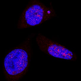 Immunocytochemistry LEF1 Antibody [Unconjugated]