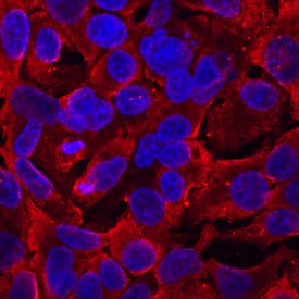 LGI2 was detected in immersion fixed HepG2 human hepatocellular carcinoma cell line using Mouse Anti-Human LGI2 Monoclonal Antibody (Catalog # MAB7334) at 10 µg/mL for 3 hours at room temperature. Cells were stained using the NorthernLights™ 557-conjugated Anti-Mouse IgG Secondary Antibody (red; Catalog # NL007) and counter-stained with DAPI (blue). Specific staining was localized to cytoplasm. View our protocol for Fluorescent ICC Staining of Cells on Coverslips.