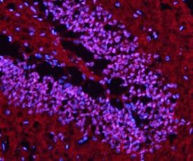 Immunohistochemistry LHX5 Antibody