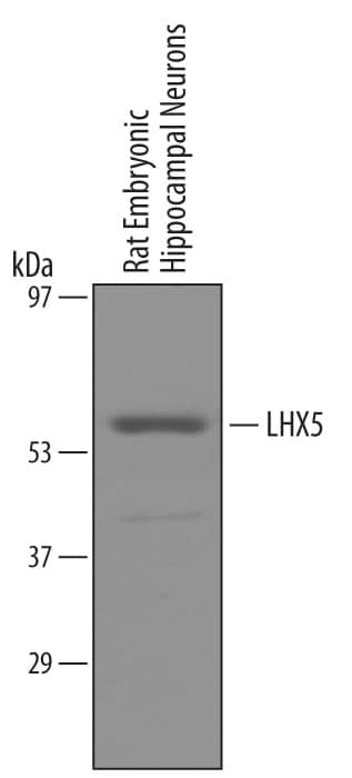 Western Blot LHX5 Antibody