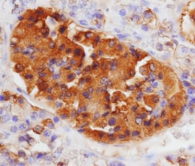 Immunohistochemistry LH beta Antibody
