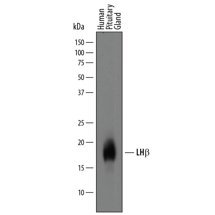 Western Blot LH beta Antibody