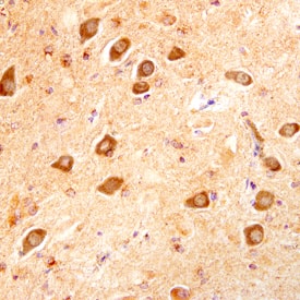 Immunohistochemistry LIF Antibody [Unconjugated]