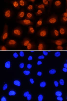 Immunocytochemistry LIMD1 Antibody (919330) [Unconjugated]