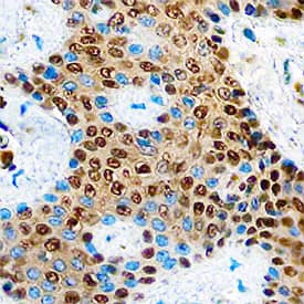Immunohistochemistry LIMD1 Antibody (919330) [Unconjugated]