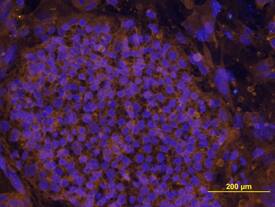 LIN-41 was detected in immersion fixed BG01V human embryonic stem cells using Human LIN-41 Antigen Affinity-purified Polyclonal Antibody (Catalog # AF5104) at 10 µg/mL for 3 hours at room temperature. Cells were stained using the NorthernLights™ 557-conjugated Anti-Sheep IgG Secondary Antibody (yellow; Catalog # NL010) and counterstained with DAPI (blue). View our protocol for Fluorescent ICC Staining of Cells on Coverslips.