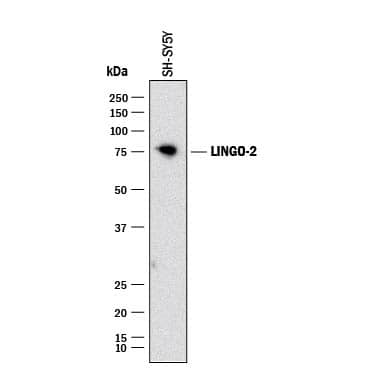 Western Blot LINGO-2 Antibody (382007) [Unconjugated]