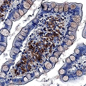 Immunohistochemistry LITAF Antibody [Unconjugated]