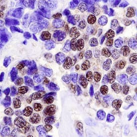Immunohistochemistry LKB1/STK11 Antibody [Unconjugated]