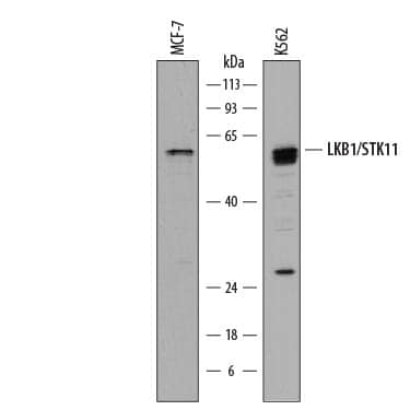 Western Blot LKB1/STK11 Antibody [Unconjugated]