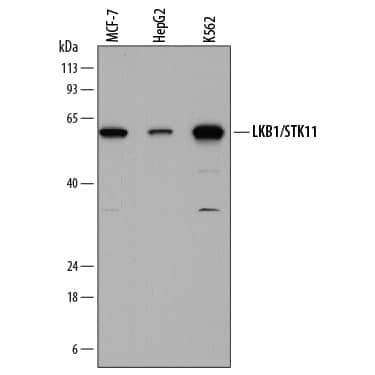 Western blot shows lysates of MCF-7 human breast cancer cell line, HepG2 human hepatocellular carcinoma cell line, and K562 human chronic myelogenous leukemia cell line. PVDF membrane was probed with 1 µg/mL of Mouse Anti-Human LKB1/STK11 Monoclonal Antibody (Catalog # MAB8055) followed by HRP-conjugated Anti-Mouse IgG Secondary Antibody (Catalog # HAF018). A specific band was detected for LKB1/STK11 at approximately 55 kDa (as indicated). This experiment was conducted under reducing conditions and using Immunoblot Buffer Group 1.