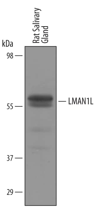 Western Blot LMAN1L/SLAMP Antibody [Unconjugated]