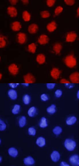 LMO2 was detected in immersion fixed K562 human chronic myelogenous leukemia cell line using Human LMO2 Antigen Affinity-purified Polyclonal Antibody (Catalog # AF2726) at 10 µg/mL for 3 hours at room temperature. Cells were stained using the NorthernLights™ 557-conjugated Anti-Goat IgG Secondary Antibody (red, upper panel; Catalog # NL001) and counterstained with DAPI (blue, lower panel). Specific staining was localized to nuclei. View our protocol for Fluorescent ICC Staining of Non-adherent Cells.