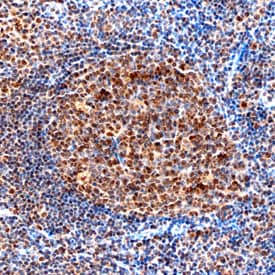 LMO2 was detected in formalin fixed paraffin-embedded sections of human tonsil using Mouse Anti-Human LMO2 Monoclonal Antibody (Catalog # MAB2726) at 15 µg/mL overnight at 4 °C. Tissue was stained using the Anti-Mouse HRP-DAB Cell & Tissue Staining Kit (brown; Catalog # CTS002) and counterstained with hematoxylin (blue). Specific staining was localized to the nucleus. View our protocol for Chromogenic IHC Staining of Paraffin-embedded Tissue Sections.