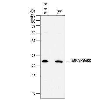 Western blot shows lysates of MOLT-4 human acute lymphoblastic leukemia cell line and Raji human Burkitt's lymphoma cell line. PVDF membrane was probed with 2 µg/mL of Mouse Anti-Human LMP7/ PSMB8 Monoclonal Antibody (Catalog # MAB7710) followed by HRP-conjugated Anti-Mouse IgG Secondary Antibody (Catalog # HAF007). A specific band was detected for LMP7/PSMB8 at approximately 23 kDa (as indicated). This experiment was conducted under reducing conditions and using Immunoblot Buffer Group 1.
